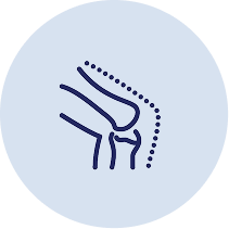 Graphic of a joint